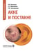 Обложка книги «Акне и постакне: руководство для врачей» — Бычкова Наталья Юрьевна;Максимова Алена Станиславовна;Загртдинова Ризида Миннесагитовна, ISBN 9785970499597